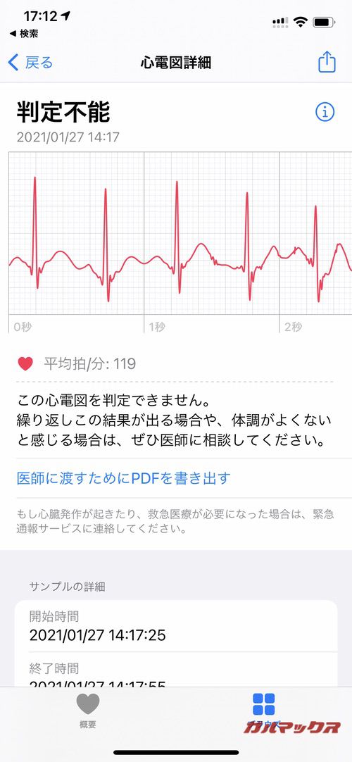 Apple Watch 心電図
