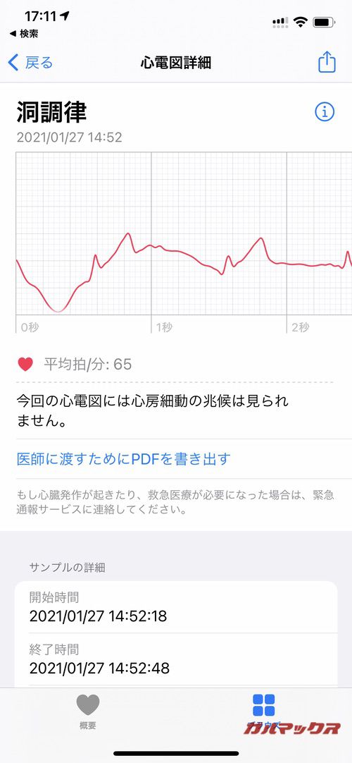 Apple Watch 心電図